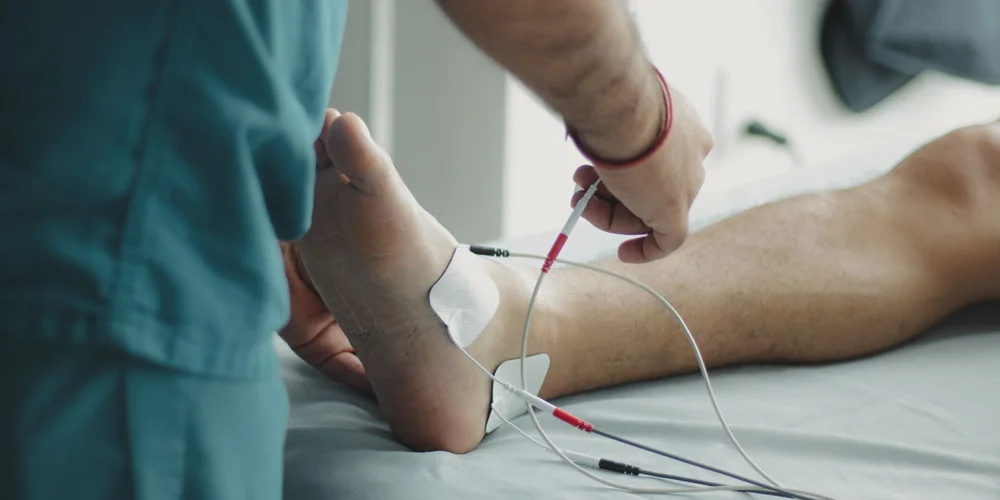 Bacak Damar Tıkanıklığında Bypass mı, Balon-Stent mi?